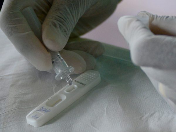 Anvisa aprova primeiro autoteste para Covid no Brasil